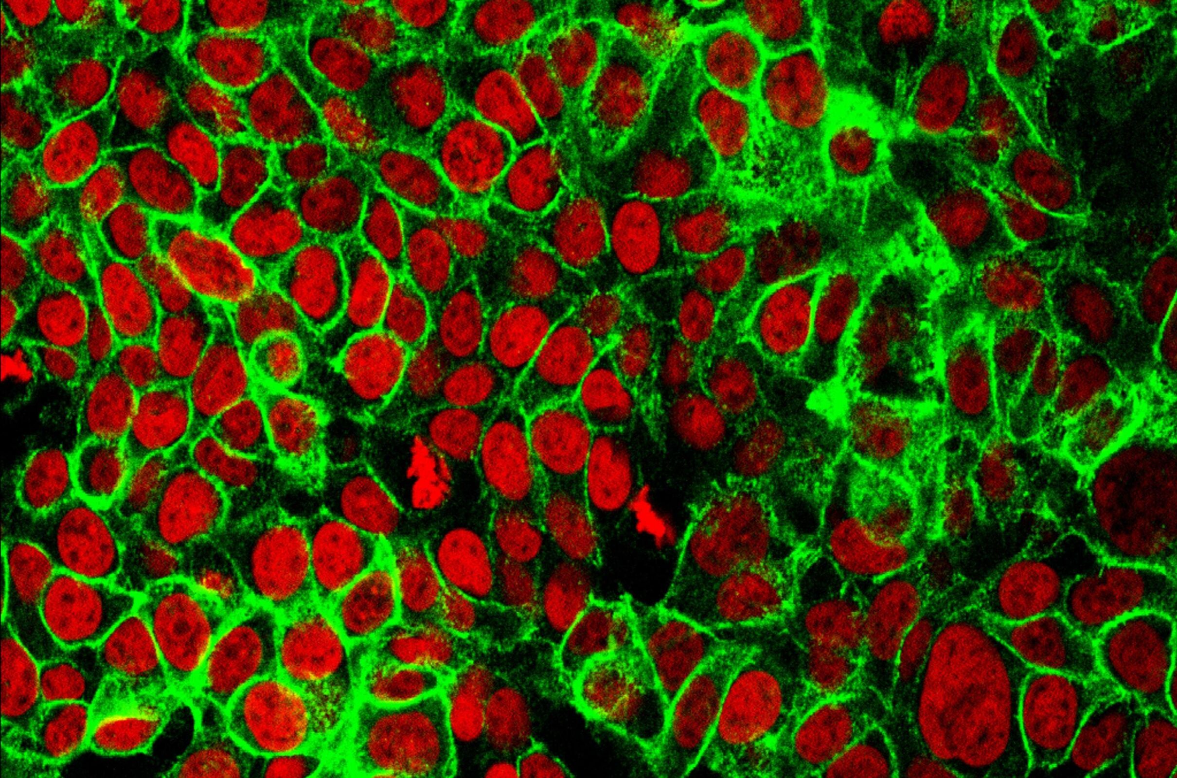 Scientists Develop Laser System to Remove Cancers without Damaging Healthy Tissue main image