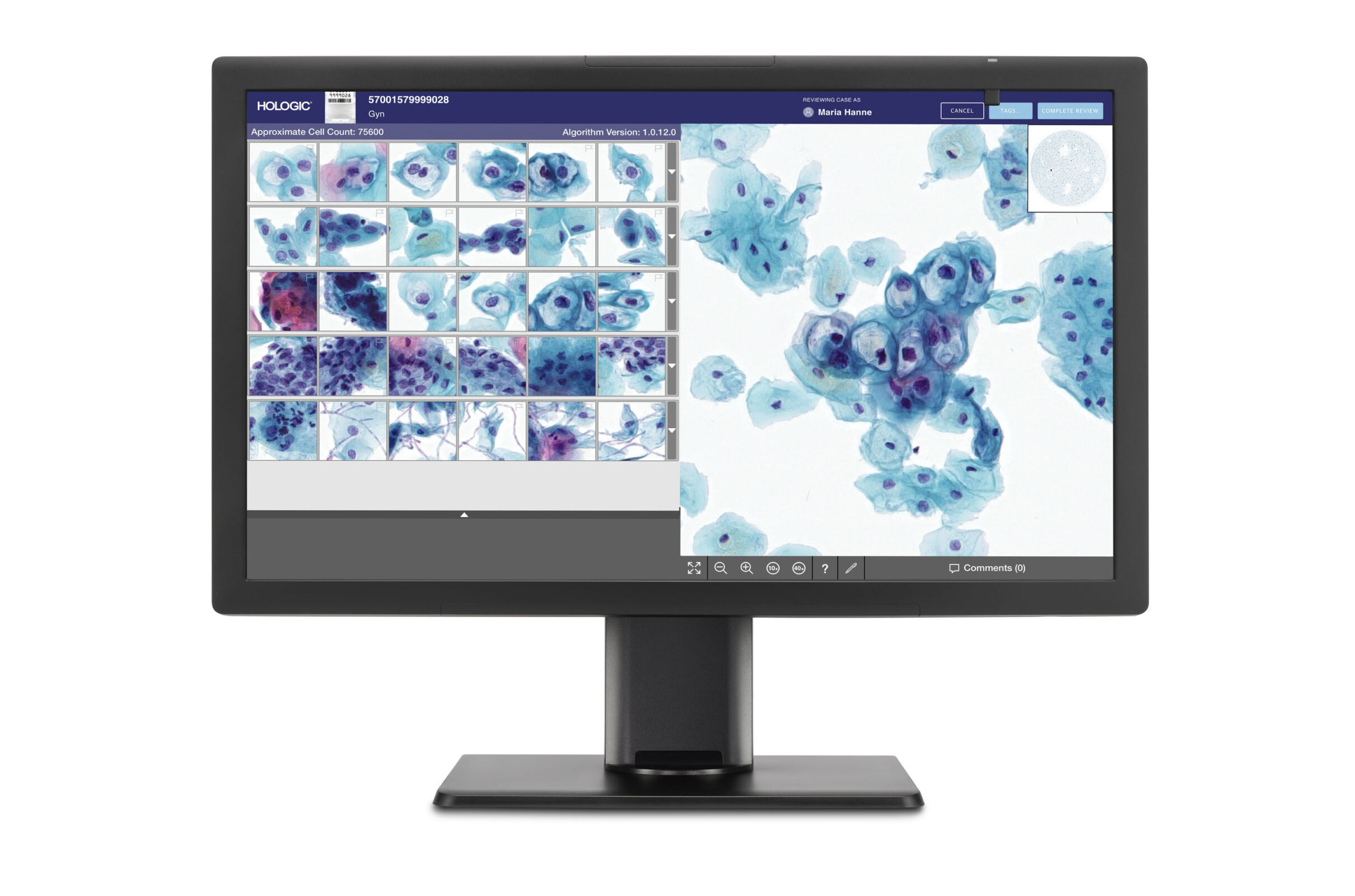 Hologic taps Google Cloud for AI-driven Cervical Cancer Screening Collaboration main image