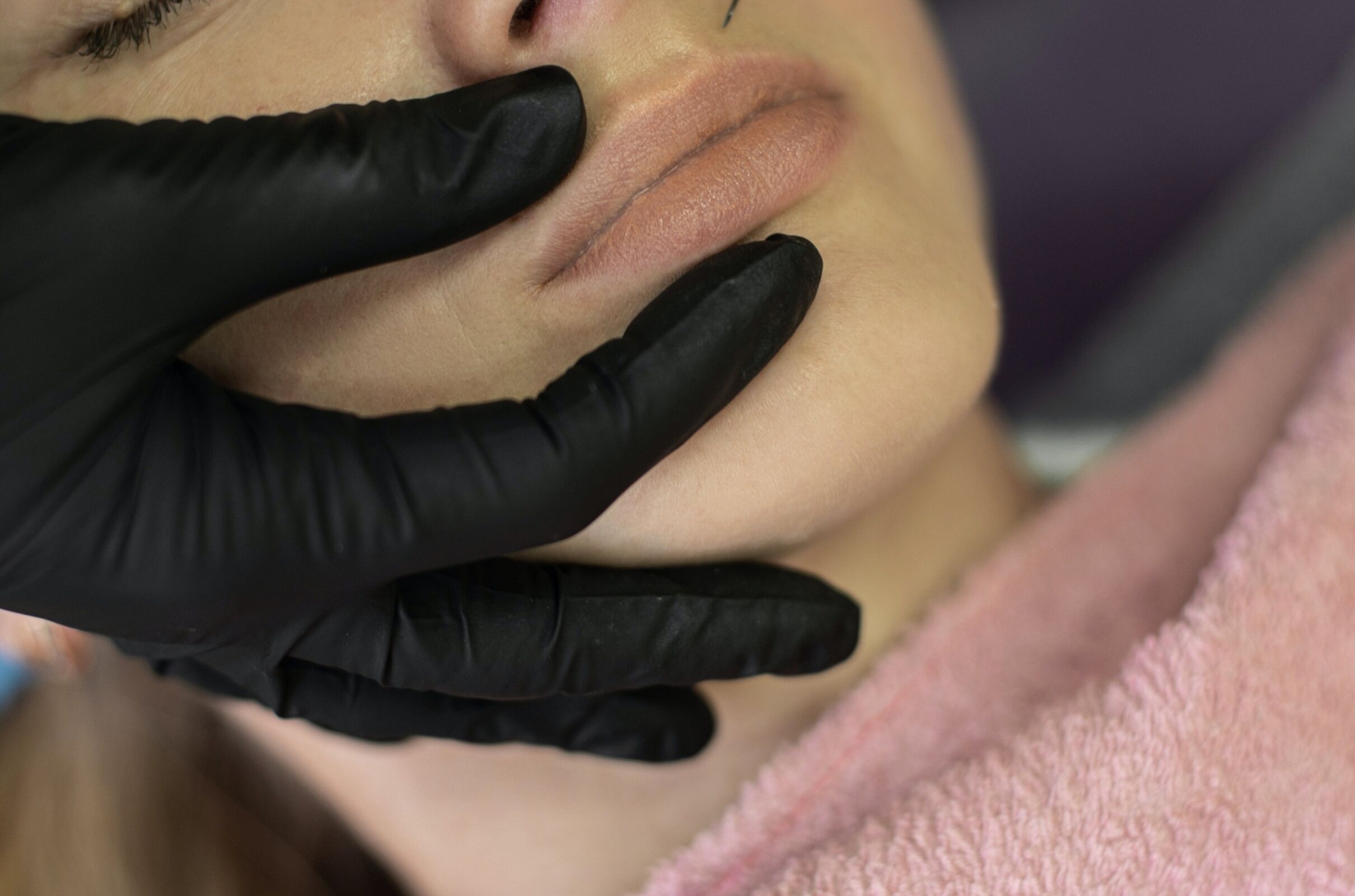 Europe Dermal Fillers Market 2023 is Anticipated To Reach USD 2.25 billion by 2029-CAGR 6.3% main image