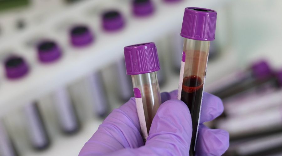 NHS to Trial Blood Test that Could Detect More than 50 Cancers