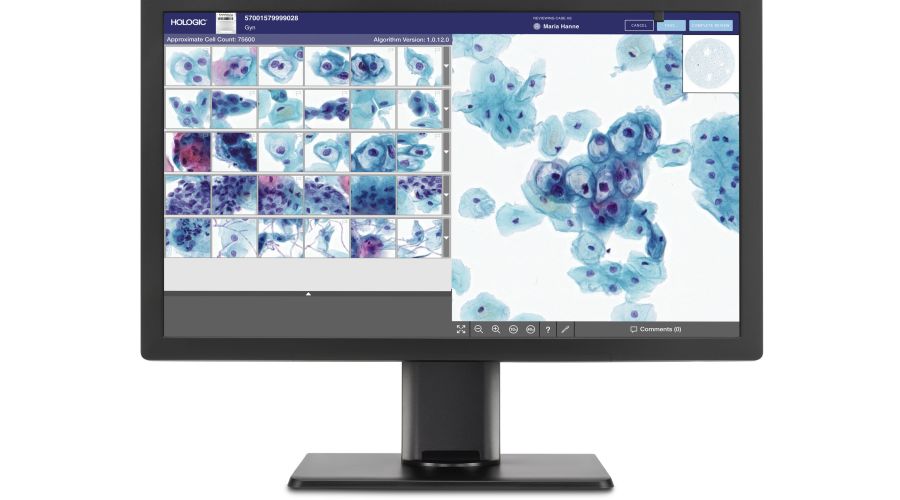 Hologic taps Google Cloud for AI-driven Cervical Cancer Screening Collaboration