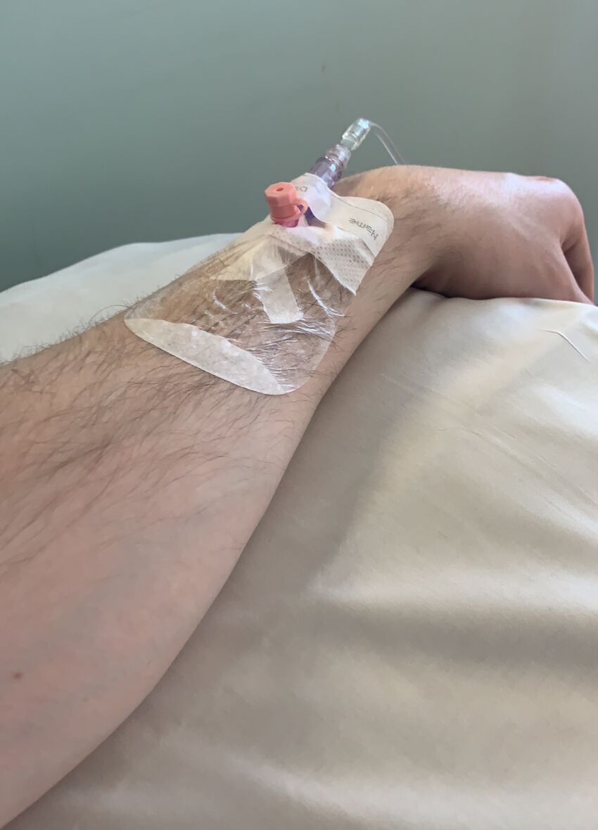 cannula fitted for chemotherapy
