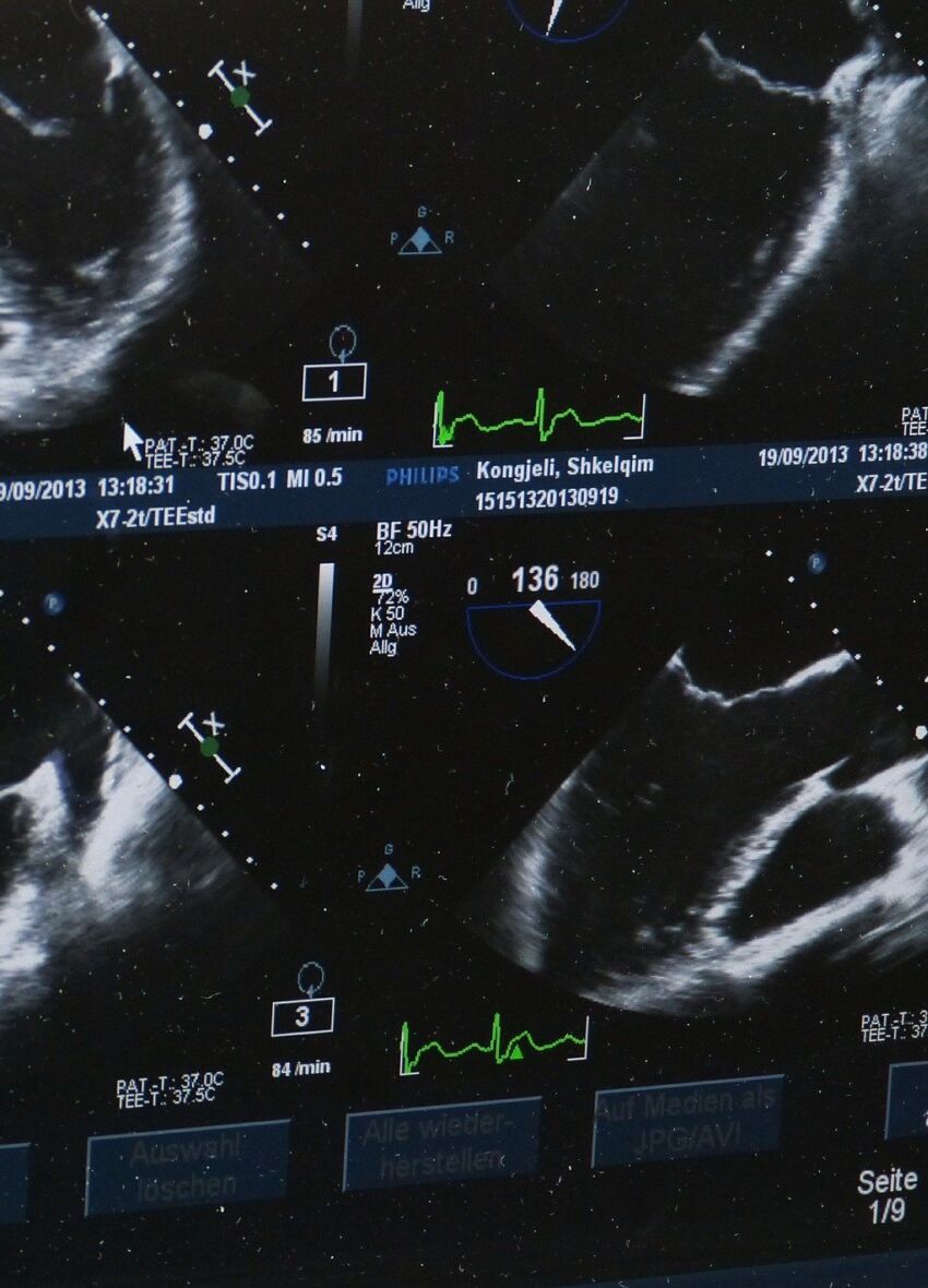 Ultrasound xray Image
